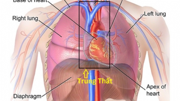 Sinh thiết khối u phổi xuyên thành ngực dưới hướng dẫn của chụp cắt lớp vi tính